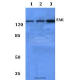 Anti-FAK (I855) Antibody from Bioworld Technology (BS3583) - Antibodies.com