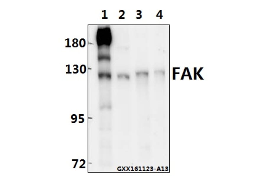 Anti-FAK (I855) Antibody from Bioworld Technology (BS3583) - Antibodies.com
