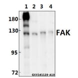 Anti-FAK (I855) Antibody from Bioworld Technology (BS3583) - Antibodies.com