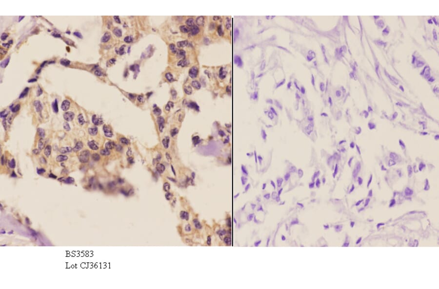 Anti-FAK (I855) Antibody from Bioworld Technology (BS3583) - Antibodies.com