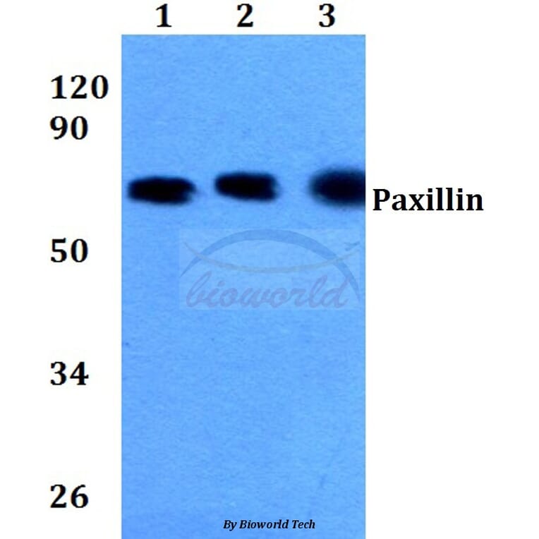 Anti-Paxillin (L25) Antibody from Bioworld Technology (BS3585) - Antibodies.com