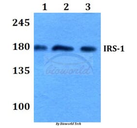 Anti-IRS-1 (R301) Antibody from Bioworld Technology (BS3589) - Antibodies.com