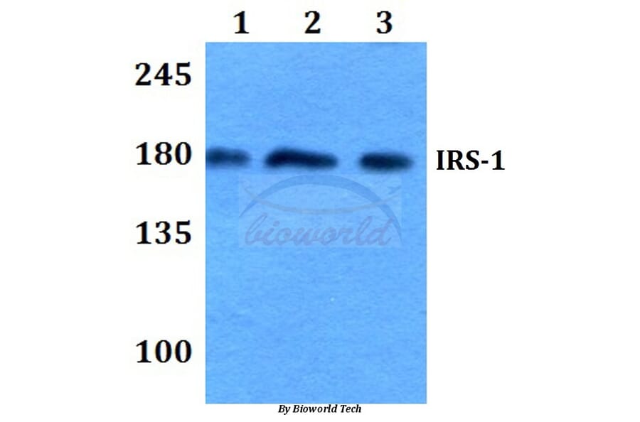 Anti-IRS-1 (R301) Antibody from Bioworld Technology (BS3589) - Antibodies.com