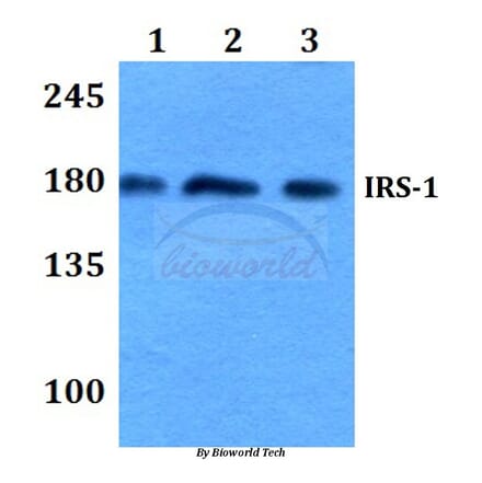 Anti-IRS-1 (R301) Antibody from Bioworld Technology (BS3589) - Antibodies.com