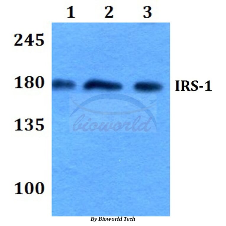 Anti-IRS-1 (R301) Antibody from Bioworld Technology (BS3589) - Antibodies.com