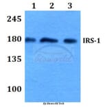 Anti-IRS-1 (R301) Antibody from Bioworld Technology (BS3589) - Antibodies.com