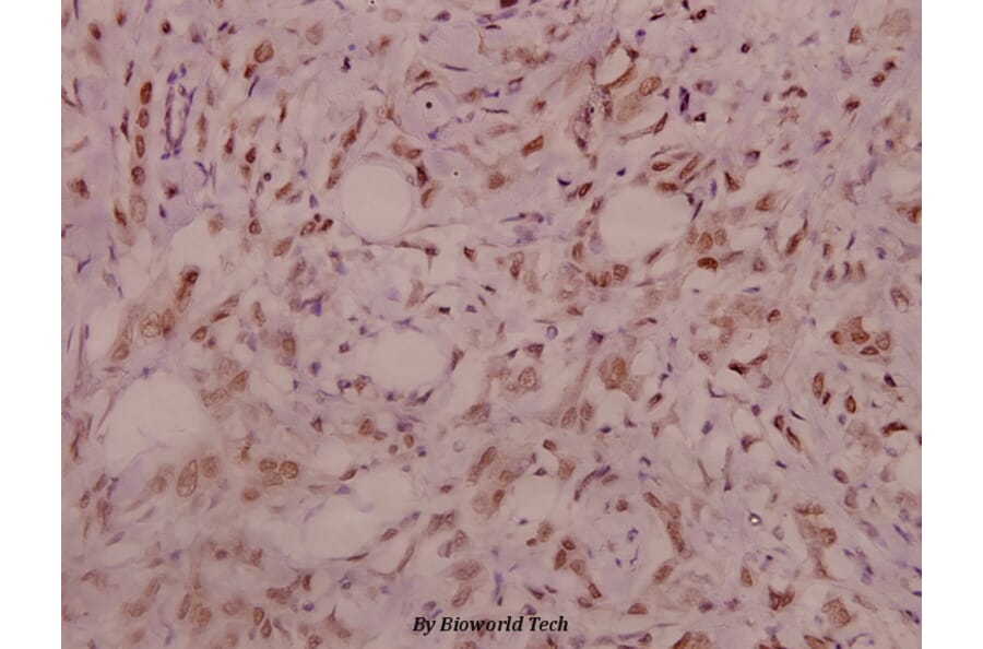 Anti-IRS-1 (R301) Antibody from Bioworld Technology (BS3589) - Antibodies.com