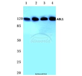 Anti-ABL1 (L406) Antibody from Bioworld Technology (BS3592) - Antibodies.com