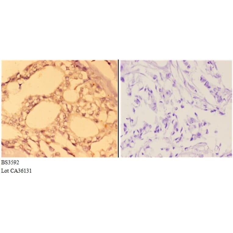 Anti-ABL1 (L406) Antibody from Bioworld Technology (BS3592) - Antibodies.com