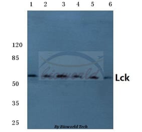 Anti-Lck (L387) Antibody from Bioworld Technology (BS3593) - Antibodies.com