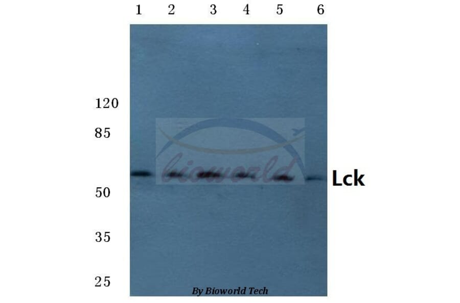 Anti-Lck (L387) Antibody from Bioworld Technology (BS3593) - Antibodies.com
