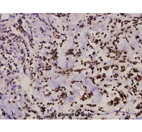 Anti-ZAP70 (S313) Antibody from Bioworld Technology (BS3596) - Antibodies.com