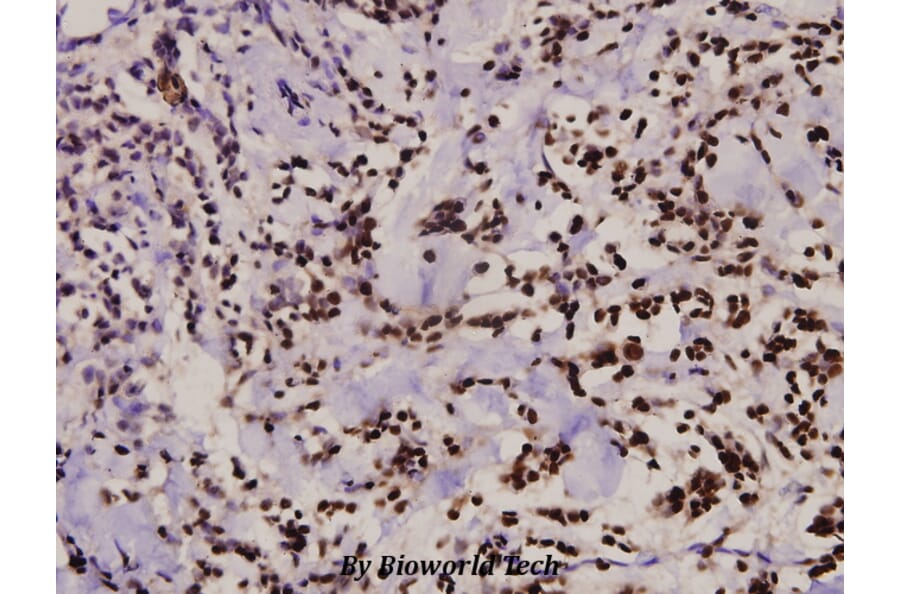 Anti-ZAP70 (S313) Antibody from Bioworld Technology (BS3596) - Antibodies.com