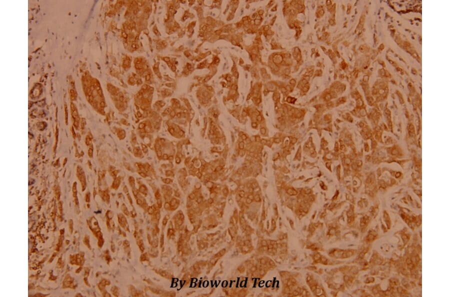 Anti-NFkB-p65 (L523) Antibody from Bioworld Technology (BS3602) - Antibodies.com