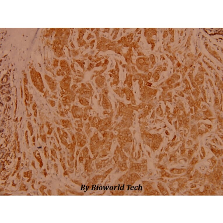 Anti-NFkB-p65 (L523) Antibody from Bioworld Technology (BS3602) - Antibodies.com