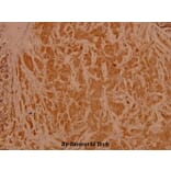 Anti-NFkB-p65 (L523) Antibody from Bioworld Technology (BS3602) - Antibodies.com