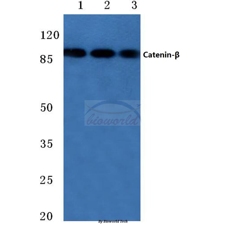 Anti-Catenin-β (Q27) Antibody from Bioworld Technology (BS3603) - Antibodies.com