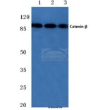 Anti-Catenin-β (Q27) Antibody from Bioworld Technology (BS3603) - Antibodies.com