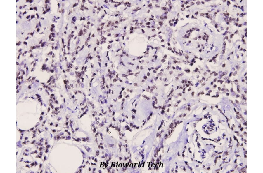 Anti-Catenin-β (Q27) Antibody from Bioworld Technology (BS3603) - Antibodies.com