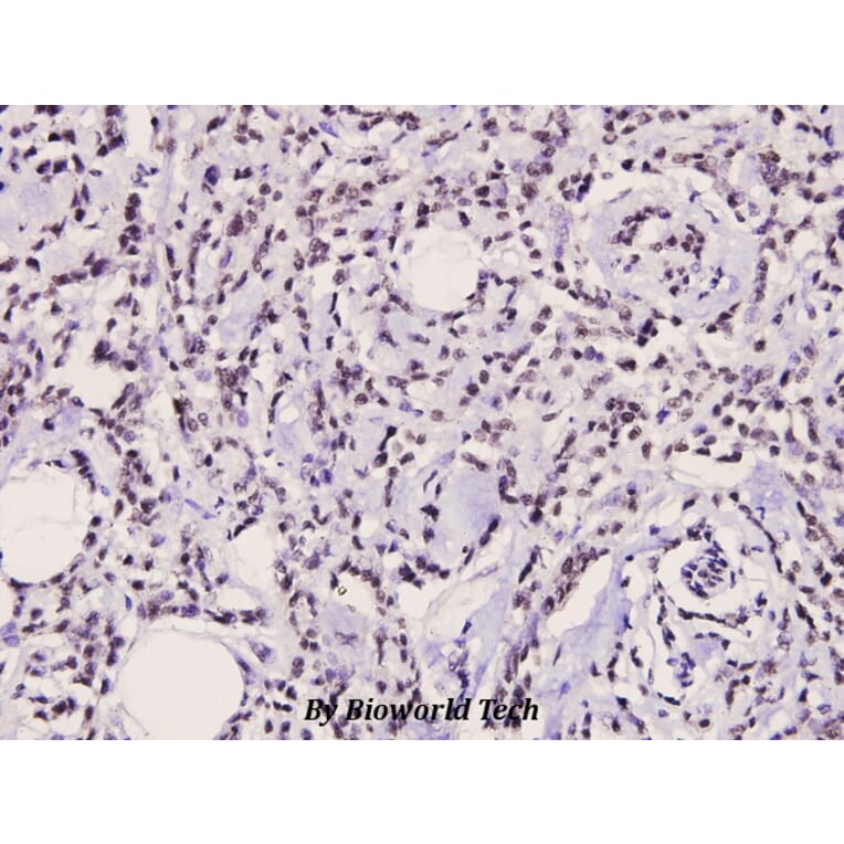 Anti-Catenin-β (Q27) Antibody from Bioworld Technology (BS3603) - Antibodies.com