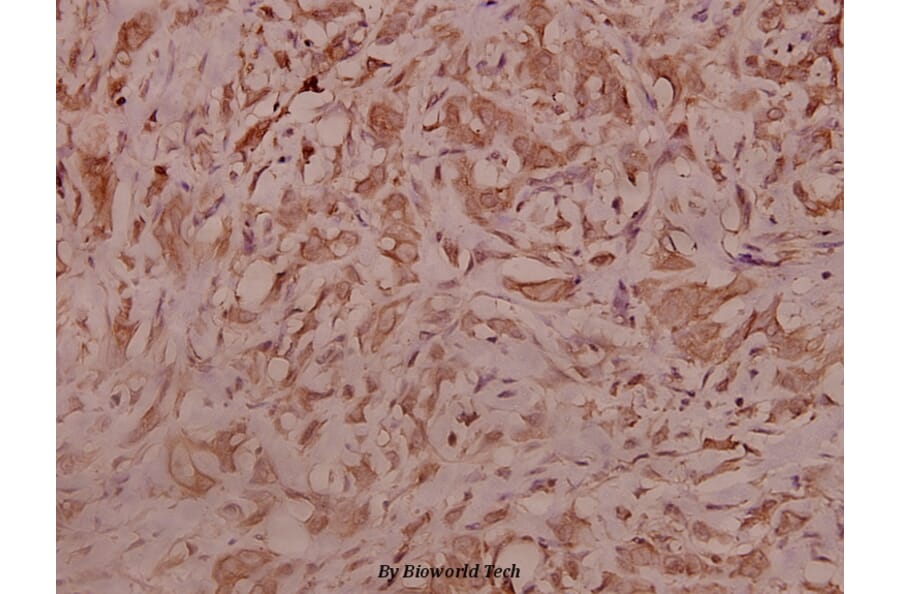 Anti-IRS-1 (G630) Antibody from Bioworld Technology (BS3608) - Antibodies.com