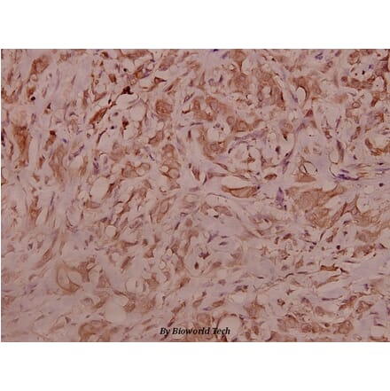 Anti-IRS-1 (G630) Antibody from Bioworld Technology (BS3608) - Antibodies.com