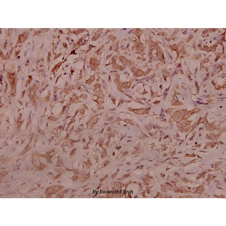 Anti-IRS-1 (G630) Antibody from Bioworld Technology (BS3608) - Antibodies.com