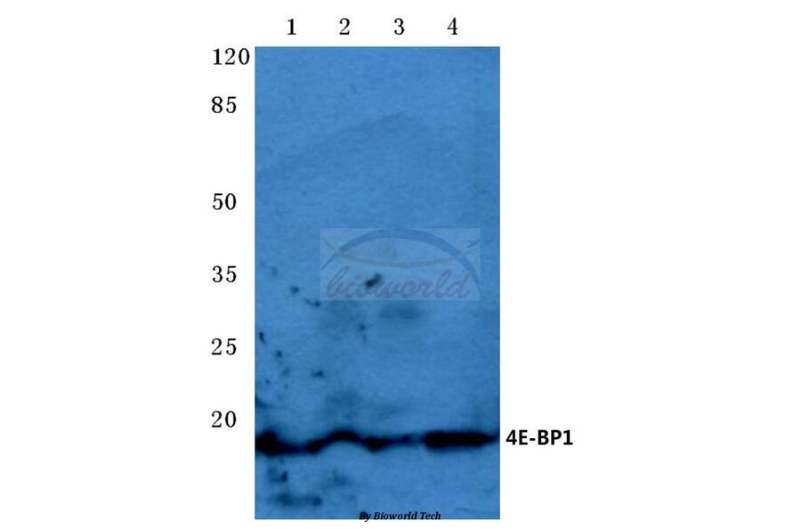 Anti-4E-BP1 (P30) Antibody from Bioworld Technology (BS3612) - Antibodies.com