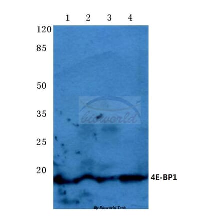 Anti-4E-BP1 (P30) Antibody from Bioworld Technology (BS3612) - Antibodies.com