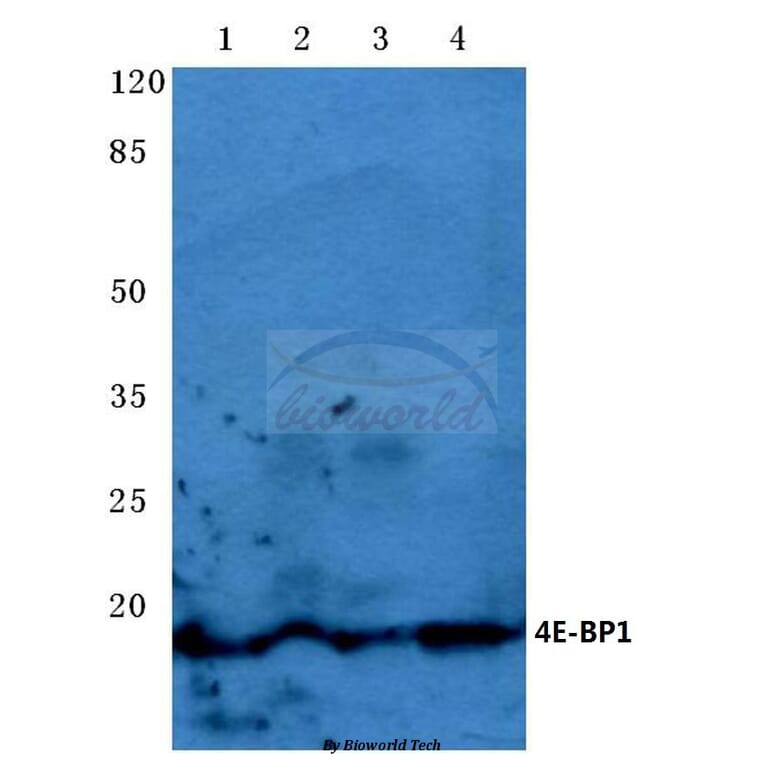 Anti-4E-BP1 (P30) Antibody from Bioworld Technology (BS3612) - Antibodies.com