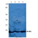 Anti-4E-BP1 (P30) Antibody from Bioworld Technology (BS3612) - Antibodies.com