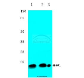 Anti-4E-BP1 (G39) Antibody from Bioworld Technology (BS3613) - Antibodies.com