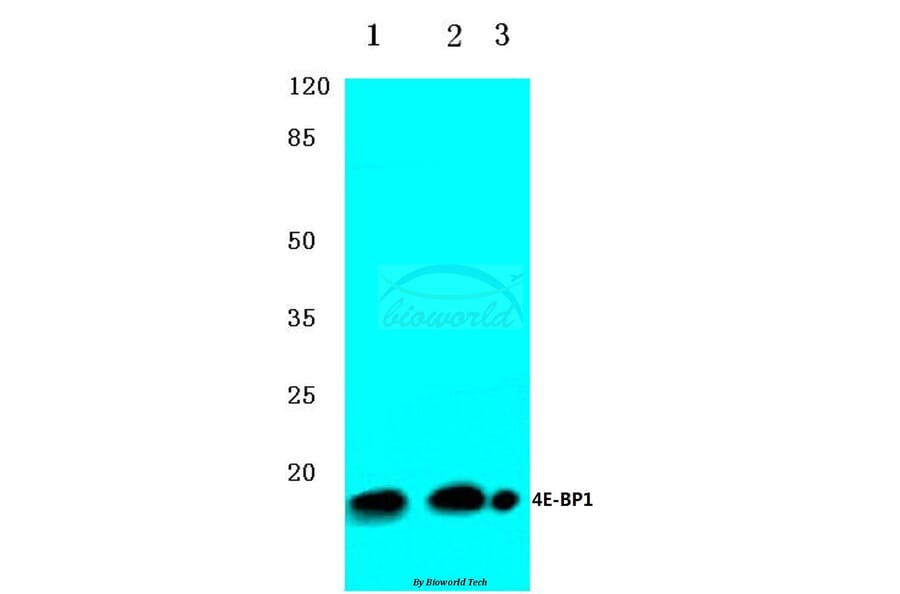 Anti-4E-BP1 (G39) Antibody from Bioworld Technology (BS3613) - Antibodies.com