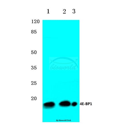 Anti-4E-BP1 (G39) Antibody from Bioworld Technology (BS3613) - Antibodies.com
