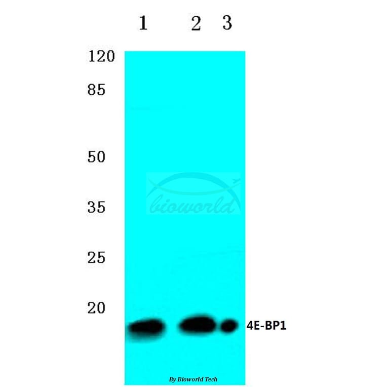 Anti-4E-BP1 (G39) Antibody from Bioworld Technology (BS3613) - Antibodies.com