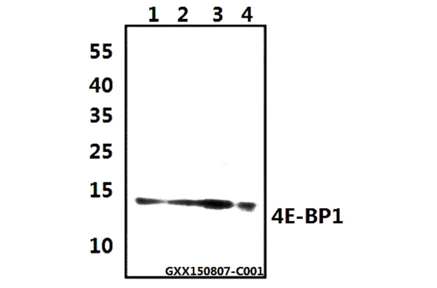 Anti-4E-BP1 (G39) Antibody from Bioworld Technology (BS3613) - Antibodies.com
