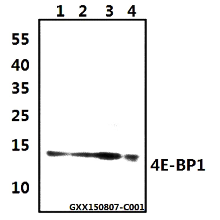 Anti-4E-BP1 (G39) Antibody from Bioworld Technology (BS3613) - Antibodies.com