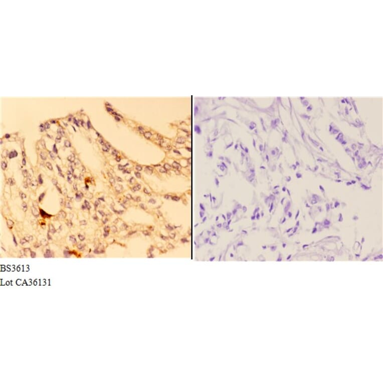 Anti-4E-BP1 (G39) Antibody from Bioworld Technology (BS3613) - Antibodies.com