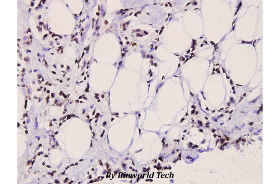 Anti-Op18 (A18) Antibody from Bioworld Technology (BS3615) - Antibodies.com
