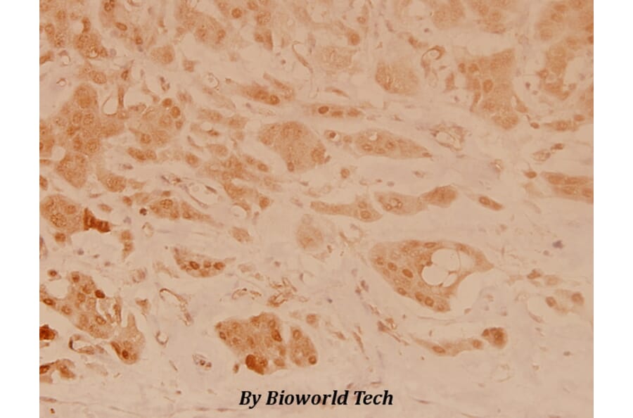 Anti-Op18 (V31) Antibody from Bioworld Technology (BS3616) - Antibodies.com