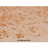 Anti-Op18 (V31) Antibody from Bioworld Technology (BS3616) - Antibodies.com