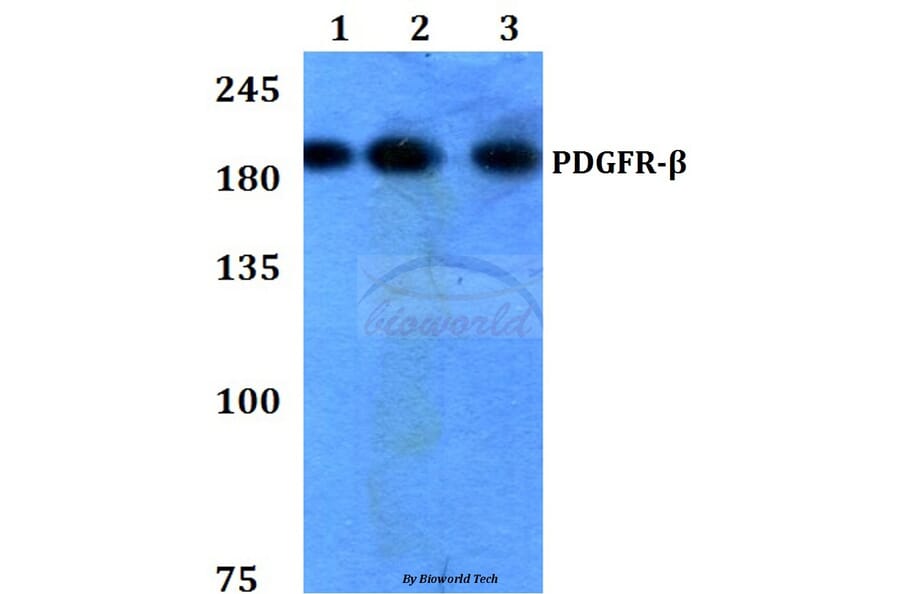 Anti-PDGFR-β (K745) Antibody from Bioworld Technology (BS3617) - Antibodies.com
