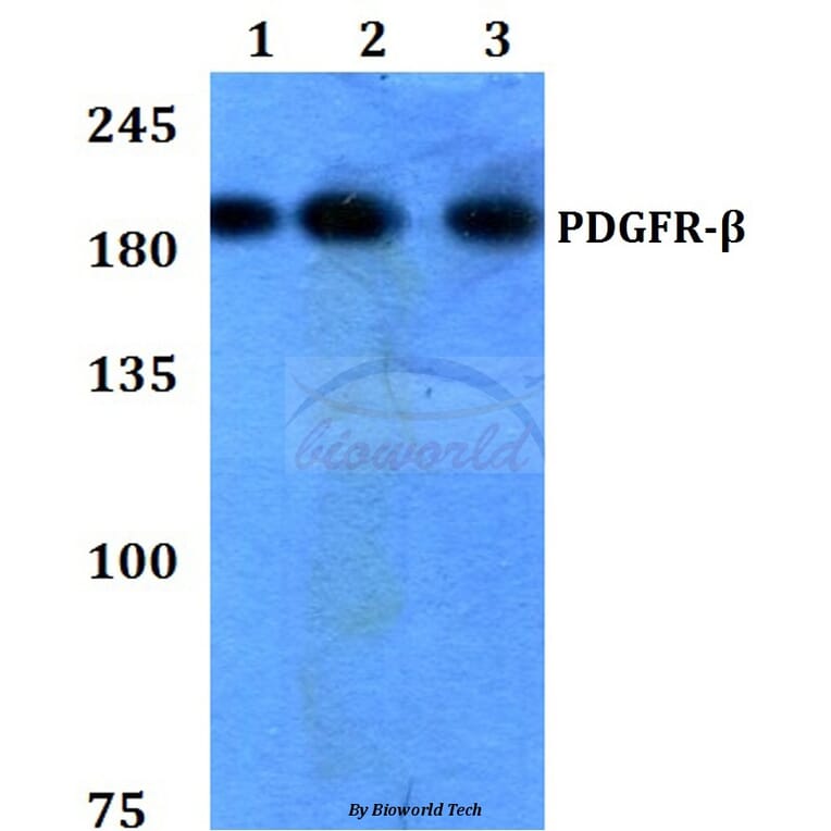 Anti-PDGFR-β (K745) Antibody from Bioworld Technology (BS3617) - Antibodies.com