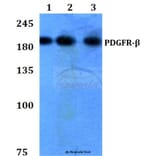 Anti-PDGFR-β (K745) Antibody from Bioworld Technology (BS3617) - Antibodies.com