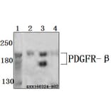 Anti-PDGFR-β (K745) Antibody from Bioworld Technology (BS3617) - Antibodies.com