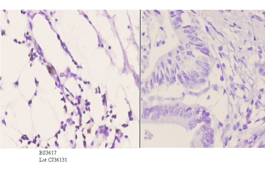 Anti-PDGFR-β (K745) Antibody from Bioworld Technology (BS3617) - Antibodies.com