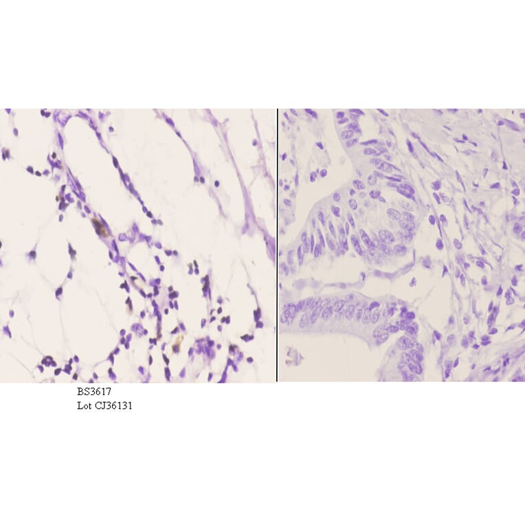Anti-PDGFR-β (K745) Antibody from Bioworld Technology (BS3617) - Antibodies.com