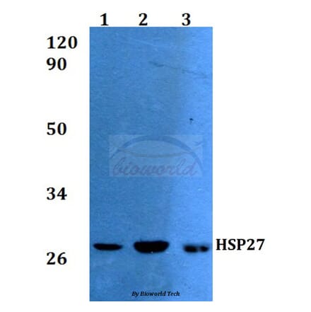 Anti-HSP27 (A72) Antibody from Bioworld Technology (BS3629) - Antibodies.com