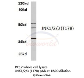 Anti-JNK1/2/3 (T178) Antibody from Bioworld Technology (BS3630) - Antibodies.com