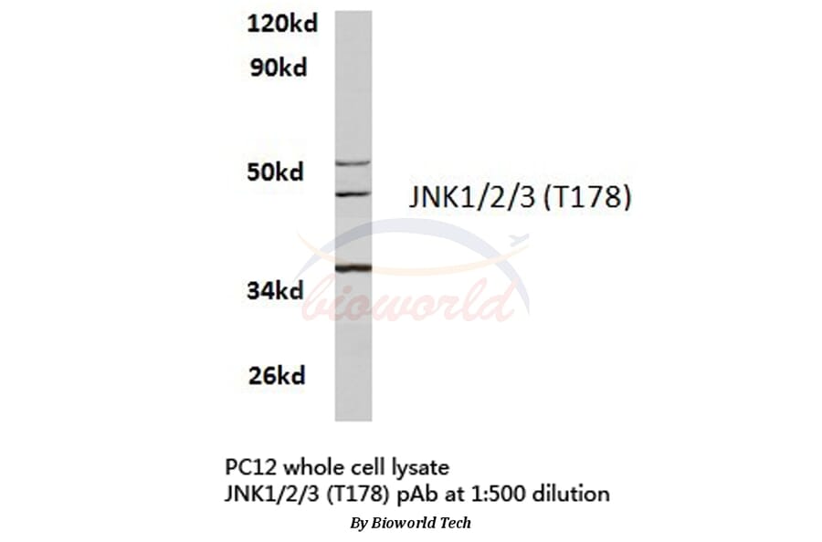 Anti-JNK1/2/3 (T178) Antibody from Bioworld Technology (BS3630) - Antibodies.com